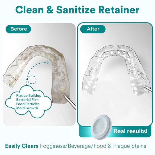 Weiss Naturals Retainer Cleaner Tablets, Invisalign Cleaner, Remove Stains, Odors & Plaque, PERSULFATE FREE Night Guard & Denture Cleaner 1-Month