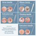 JPNK Blackhead Remover Tool Comedones Extractor Acne Removal Kit for Blemish, Whitehead Popping, 6 Pcs Zit Removing for Nose Face Tools with a