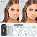 JPNK Blackhead Remover Tool Comedones Extractor Acne Removal Kit for Blemish, Whitehead Popping, 6 Pcs Zit Removing for Nose Face Tools with a