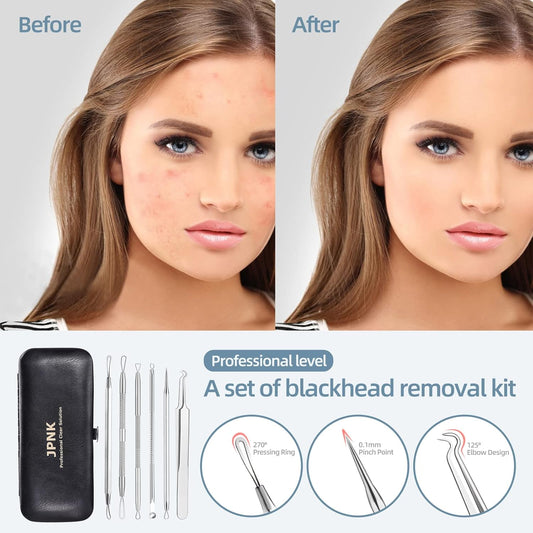 JPNK Blackhead Remover Tool Comedones Extractor Acne Removal Kit for Blemish, Whitehead Popping, 6 Pcs Zit Removing for Nose Face Tools with a
