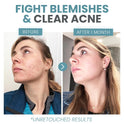 Eva Naturals Vitamin C Serum with Hyaluronic Acid - Anti-Aging, Acne & Dark Spot Care - Cart Shape