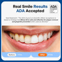 Bitvae ADA Accepted Electric Toothbrush, Travel Toothbrush Rechargeable for Adults and Kids, 60-Day Battery, 5 Modes, 8 Heads, Portable Travel Case